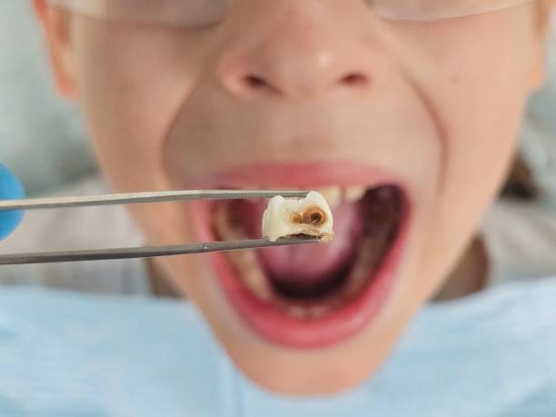 Best Pediatric Emergency Dentist in Parma, OH